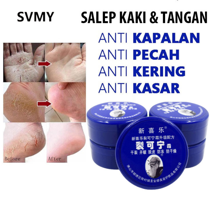 Obat Kaki Pecah2 Krim Herbal China Untuk Tumit Pecah Pecah Kapalan Dan ...