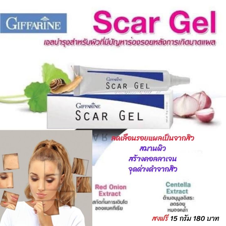 ส่งฟรี-กิฟฟารีน-ครีมลบแผลเป็น-ครีม-ครีมกำจัดรอยแผลเป็น-เจล-รอยแผลเป็น-สการ์เจล-กระตุ้น-การสร้าง-คอลลาเจน-รอยแผลเป็น-กิฟฟารีน-ของแท้