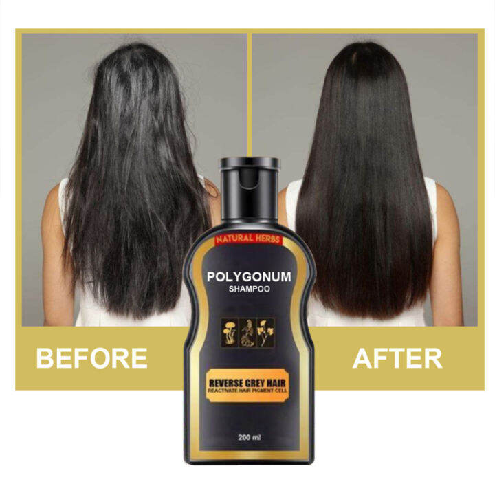 Polygonum Multiflorum Black Hair Growth Anti White Hair Shampoo Prevent