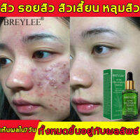 BREYLEE 17Ml หน้ากากป้องกันไอน้ำ,ป้องกันละอองน้ำช่วยเพิ่มความหนาของเกล็ดน้ำแข็งบรรจุอยู่ในน้ำช่วยเพิ่มความเป็นกรด-อะมินัทช์ระบายอากาศได้ดีเสื่อกดติดเสื้อแบบพิเศษ