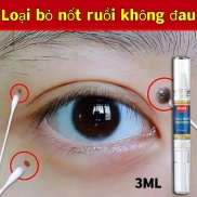 TAG&WART REMOVER Tẩy nốt ruồi Loại bỏ mụn ruồi trâu,mụn thịt,mụn cóc