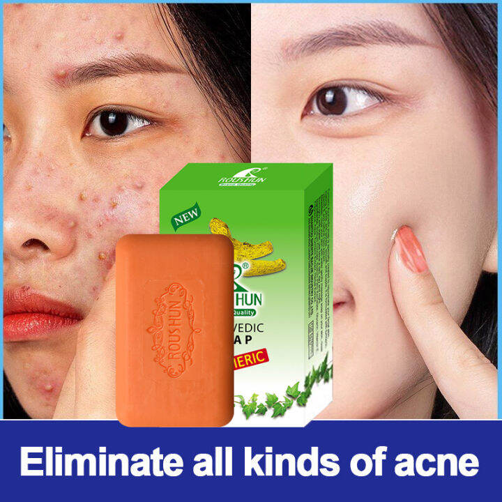 Turmeric Soap Whitening Soap Acne Antiaging Moisturizing Deep Cleaning