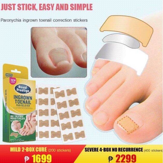 coolrich 【50pcs/box 】Paronychia Ingrown Toenail Correction Stickers