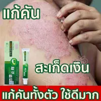 GRASS ITCHING สะเก็ดเงิน กลาก ครีมลดอาการคัน ทาแก้คัน ผิวหนังทากากเกลื้อน สารสกัดจากพืชใช้ได้ทั้งตัวบอกลาผิวคันได้ง่ายๆ itchingcream【20g】