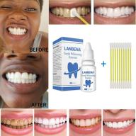 Tinh chất làm trắng răng ,dung dịch làm trắng răng,vệ sinh răng miệng,loại bỏ vết bẩn,răng ố vàng thumbnail