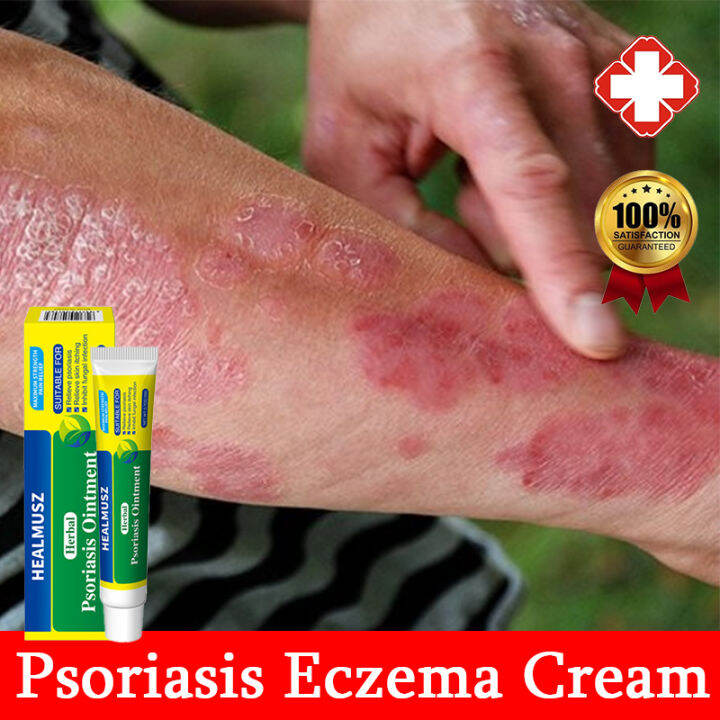 😍See results the same day 👍Psoriasis Eczema Treatment Cream Ointment