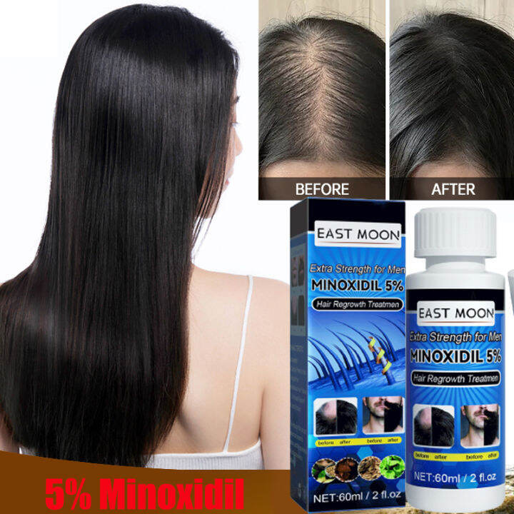 East Moon Minoxidil Strands 6% Minoxidil Topical Solution 60ml Hair 