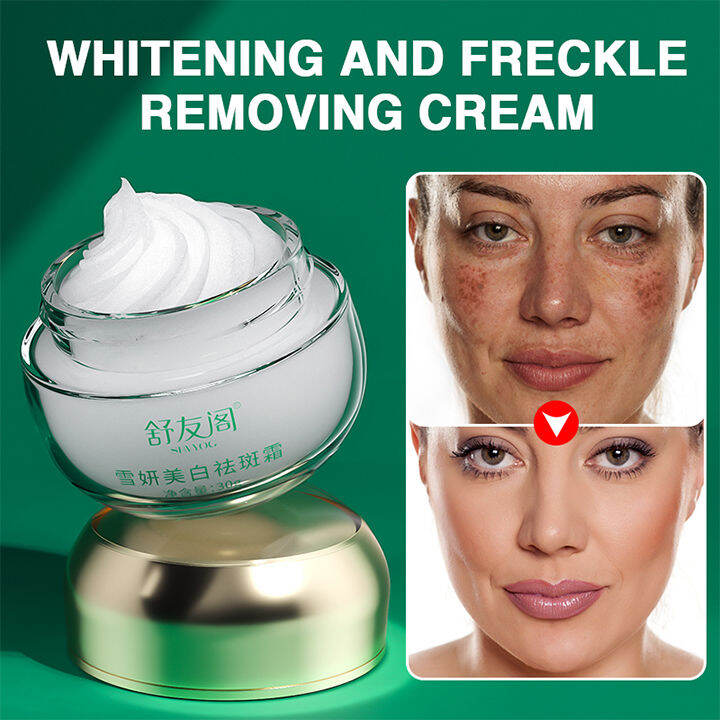 SHVYOG Whitening and anti-freckle cream Remove Dark Spots moisturizing ...