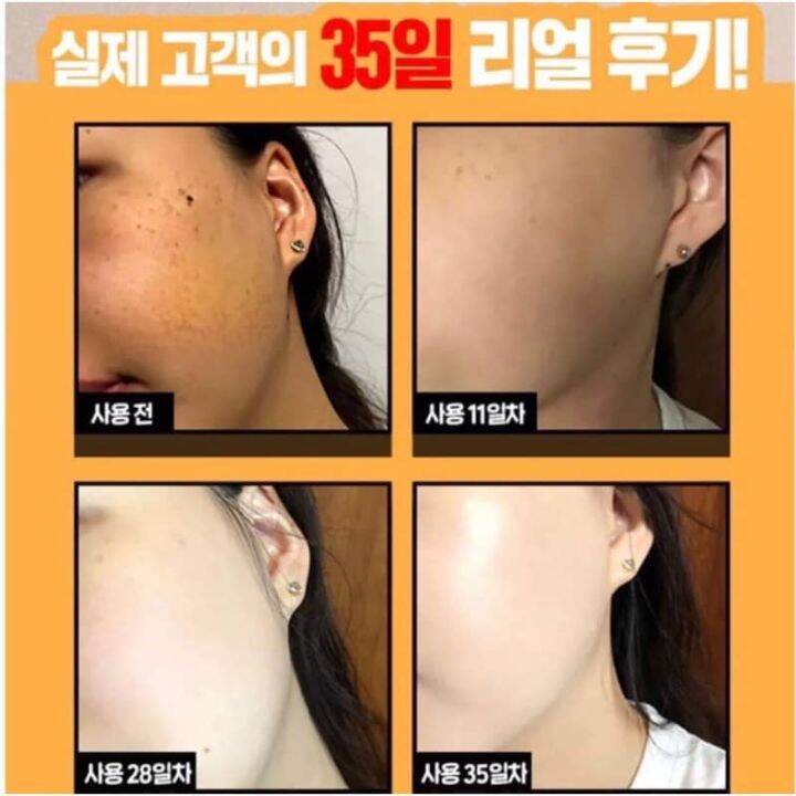 label-young-shocking-whitening-cream-pack-50-g-มาสกบำรุงผิวหน้า-ลดจุดด่างดำ-ลดฝ้า-ลดกระ-ช่วยปรับให้ผิวขาว-กระจ่างใส