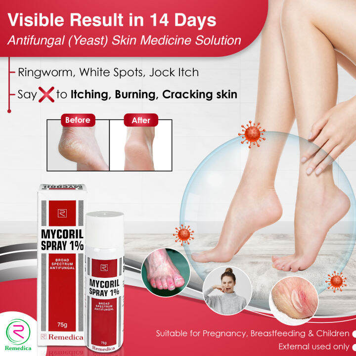 Mycoril Antifungal Foot/ Toes/Nail Medicine Nongreasy Spray 75g