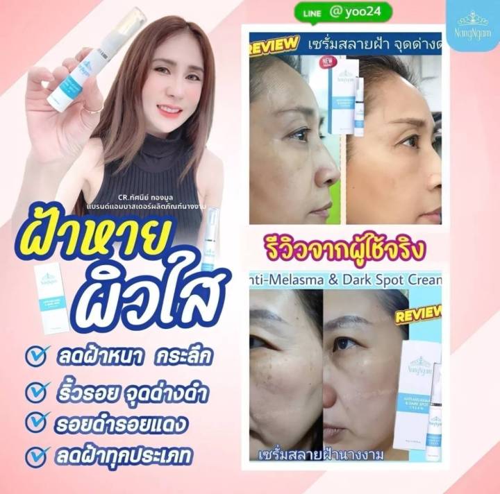 ครีมแก้ฝ้านางงาม-2-หลอด-ราคาพิเศษ-anti-melasma-amp-dark-spot-cream-ครีมทาฝ้า-นางงาม