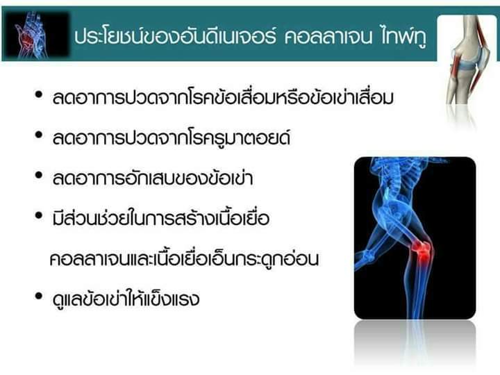 ucii-uc2-ยูซีทู-สารสกัดจากอเมริกา-แก้ปัญหา-โรคข้อเสื่อม-เข่าเสื่อม-ปวดข้อ-ปวดเข่า-30-แคปซูล-คอลลาเจน-ไทพ์ทู