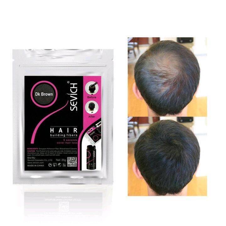 SEVICH Hair Building Fiber Cover Hair Loss Hair REFILL 25g Lazada PH