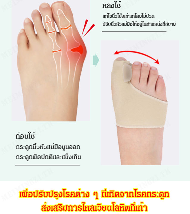 meimingzi-ถุงเท้าปรับรูปร่างนิ้วโป้ง-แก้ปัญหานิ้วโป้งหมอนแบนและการเกิดเส้นเอ็นท์