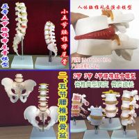 The 2345 level model demonstrate human pelvis bone pelvis intervertebral disc herniation coccyx medical spine