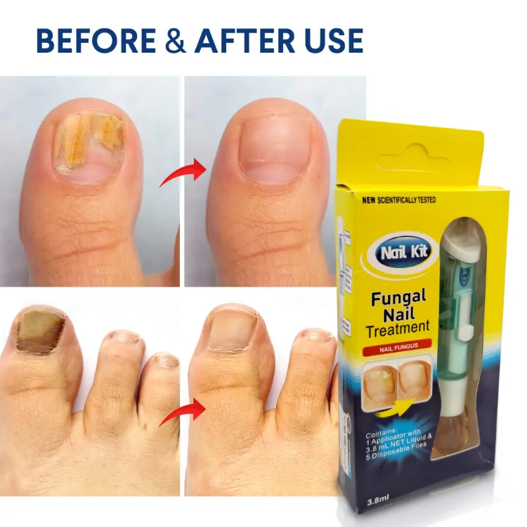 Boots fungal nail treatment | Product + price comparison