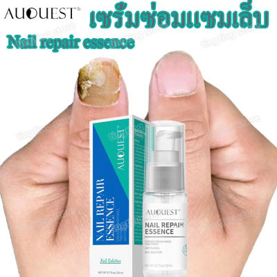 AuQuest เซรั่มทาเล็บ เชื้อราเล็บมือ 20ml ยาทาเชื้อราที่เล็บ ทาเล็บ น้ำยาทาเล็บ น้ำมันทาเล็บ ทาเชื้อราที่เล็บ ทาเล็บขบ เล็บหนา เล็บแตก ทาเล็บ ทาเชื้อราเล็บ ทาเล็บเสีย Nail Repair