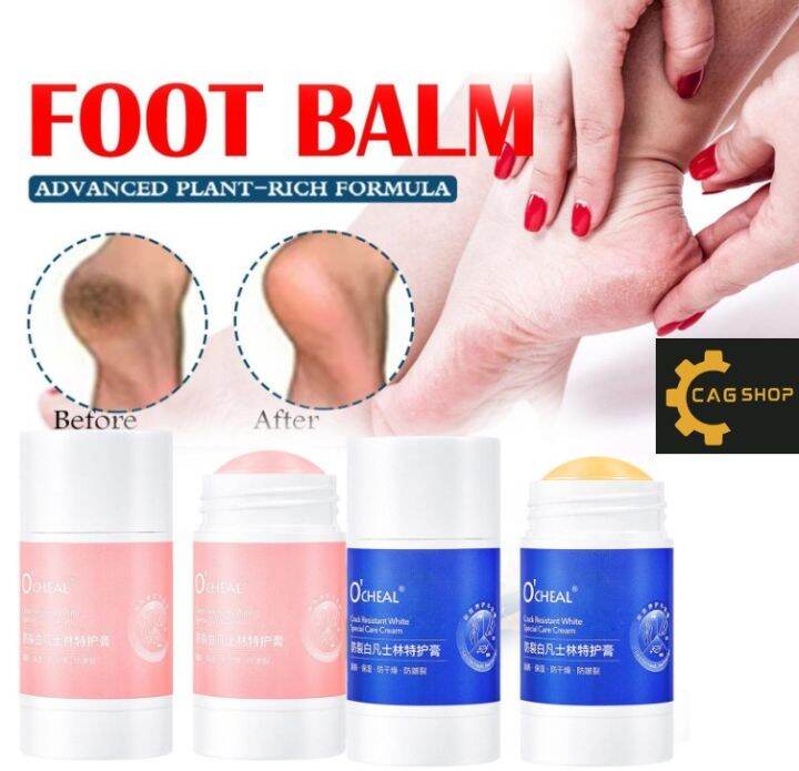 ocheal-anti-drying-crack-foot-cream-hand-cracked-repair-cream-removal