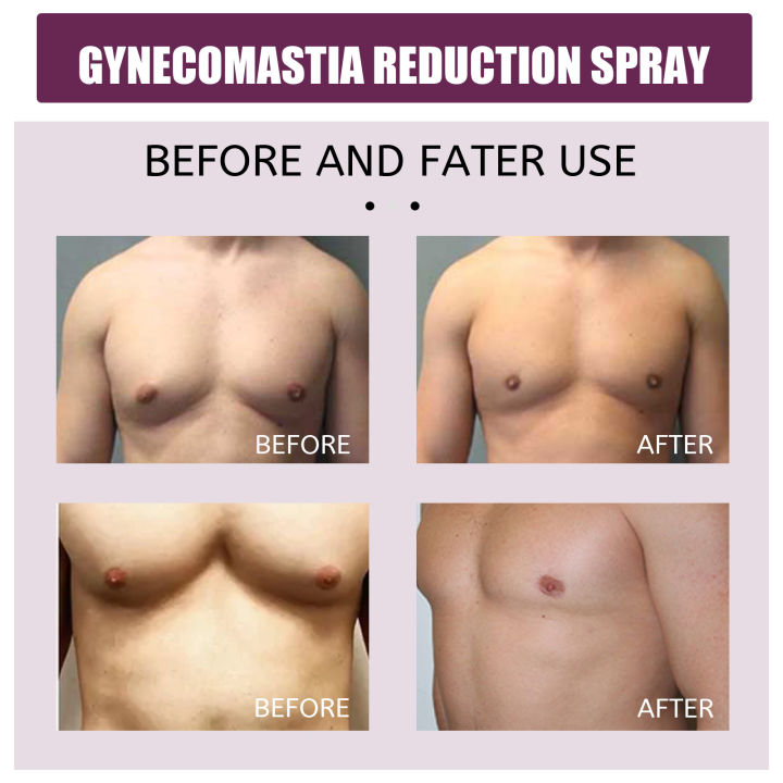 ทิศใต้-gynecomastia-สเปรย์กระชับกล้ามเนื้อเร่งหน้าอกฟิตเนสกล้ามเนื้อแข็งสเปรย์กระชับหน้าอกลดเซลลูไลท์ของเหลวรูปร่างร่างกาย-30มล