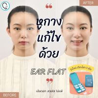 พร้อมส่งจากไทย แก้ปัญหาหูกางด้วย Ear flat ปรับปรุงใหม่เนียนใส/บางกว่าเดิม ใช้คู่กับกาวรียูส(ตัวแทนจำหน่ายในไทย)_OP017