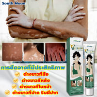 ?7วัน เห็นผล?South Moon ครีมทาด่างขาว 20g สารสกัดจากสมุนไพร ไม่ระคายเคือง ใช้ได้ทั้งร่างและทุกวัย ผลิตภัณฑ์กระตุ้นการสร้างเม็ดสีของผิว โรคด่างขาว โรคผิวหนัง ผลิตภัณฑ์ Vitiligo ด่างขาวที่หน้า ด่างขาวที่หลัง ด่างขาวที่แขน ด่างขาวที่ขา ยาด่างขาว