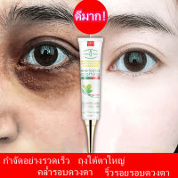 จัดส่งทันที  อายครีมที่กำจัดตุ่มไขมัน eye cream เซรั่มอายครีม แก้ปัญหารอบดวงตา  ครีมลดริ้วรอบดวงตา ​  ครีมทาใต้ตาที่ให้ชุ่มชื้น ไม่เยิ้ม ต่อต้านวัย   ครีมบำรุงรอบตา Aichunครีมทารอบดวงตา 30ml   ลบคล้ำบวมใต้ตา กระชับรอยตีนกา