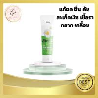 ของแท้!! ส่งไวมาก?รีวิวเพรียบอัลตร้ายูครีม แก้เชื้อรา โรคผิวหนัง คัน ผดผื่น กลากเกลื้อน สะเก็ดเงิน ส้นเท้าแตก ข้อศอก ขาหนีบ ร่มผ้า