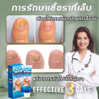 【จัดส่งจากกทม】เซรั่มรักษาเล็บ เชื้อราเล็บมือ เซรั่มบำรุงเล็บ 20g 7วัน ซ่อมแซมเล็บเสียอย่างรวดเร็ว(รักษาเล็บ เล็บเท้าคุณภาพสูงกำจัดเชื้อราที่เล็บ เอ็สเซ้นซ่อมแซมเล็บเสีย  เล็บพัง เล็บขบ เซรั่มบำรุงเล็บ ครีมบำรุงซ่อมแซมเล็บ)