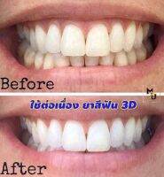 สินค้าขายดี ยาสีฟัน3D พลัส  ขนาด 50 กรัม  ยาสีฟันลดคราบหินปูน คราบกาแฟ คราบบุหรี่  ช่วยทำให้ฟันขาววมากยิ่งขึ้น