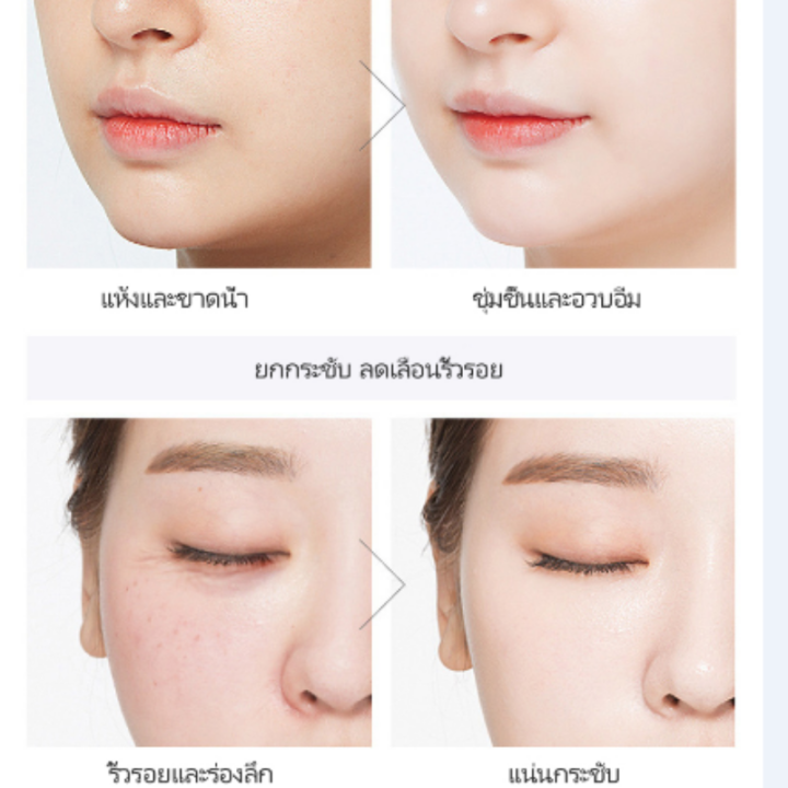 เซรั่มหน้าใส-แก่นแท้-essence-เซรั่มบำรุงผิวหน้า-ให้ความชุ่มชื้น-บำรุงผิวหน้า-การดูแลผิว-ผิวเรียบเนียน-อาหารเสริมคอลลาเจน