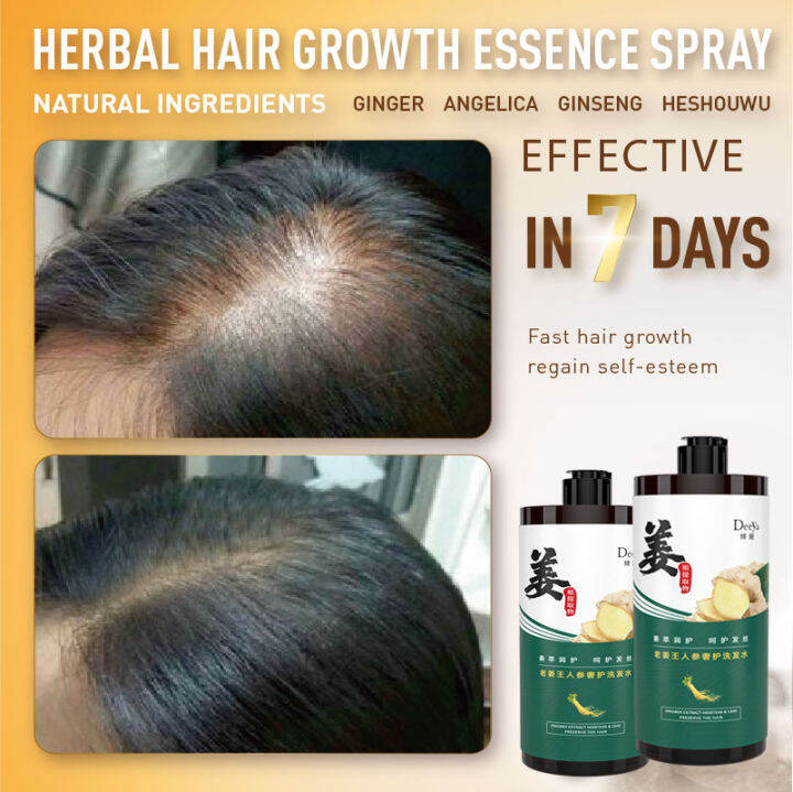 Malaysian local delivery]Men and women anti-hair loss, hair growth,  anti-dandruff and anti-itching, ginger shampoo 400ml, hair care, stop hair  loss, gradually lush hair, plant essence, available for pregnant women |  Lazada