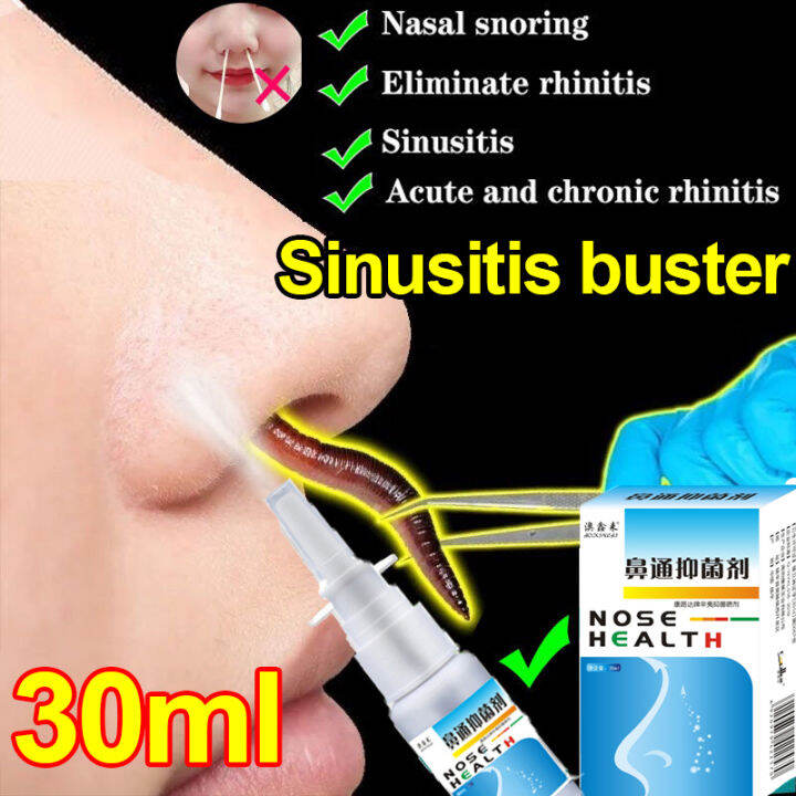 30ml Nasal Spray Chronic Rhinitis Sinusitis Spray Herb Chinese Medicine
