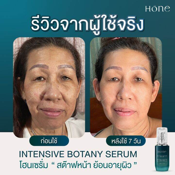 ส่งฟรี-ของแท้-โฮนเซรั่ม-เซรั่มหนุ่มกรรชัย-hone-intensive-botany-serum-ไฮยาฟิลเลอร์-โบท็อกซ์-เซรั่มผิวหน้า-ยกกระชับ-เติมความชุ่มชื่น-ลดร่อง-ริ้วรอย