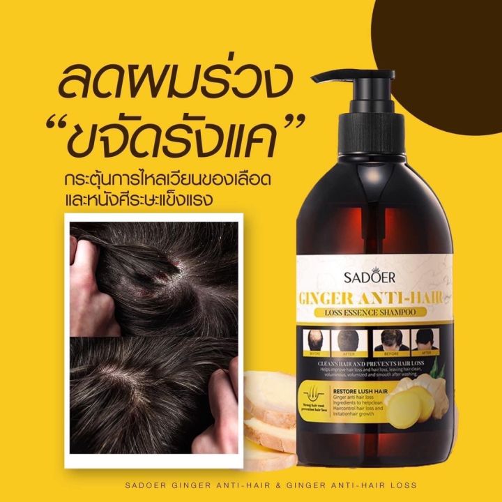 พร้อมส่ง-1-เเถม2-แชมพูขิงger-anti-hair-loss-essen-ce-shampoo-แชมพูสำหรับผมขาดหลุดร่วง-ป้องกันผมร่วงบำรุงผม-สูตรสมุนไพร-แชมพู