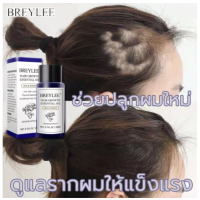 ของแท้100% BREYLEE เซรั่มปลูกผม 20ml กันผมร่วง รักษาผม ลดผมร่วง หยุดผมร่วง รักษาผมร่วง ฟื้นฟูผม Hair Growth