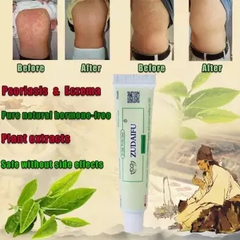 Hcmzudaifu natural chinese herbal medicine cream eczema dermatitis - ảnh sản phẩm 5