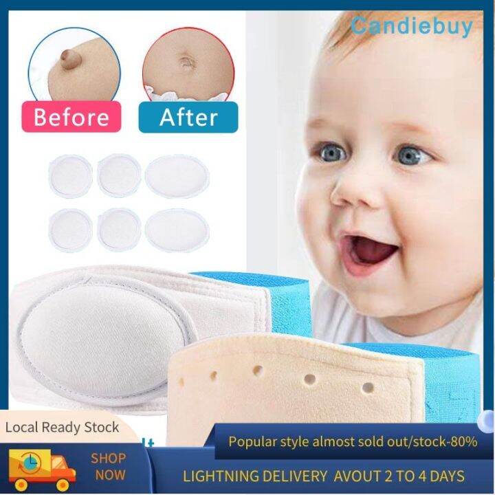 【Selling】Umbilical Hernia Baby Belly Umbilical Cord Baby Convex Belly
