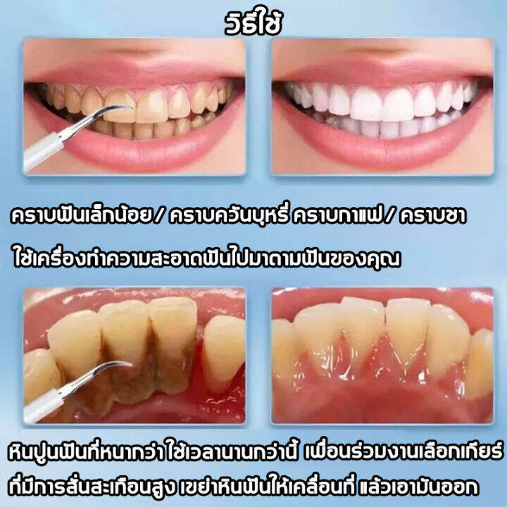 zx-beauty-shop-electric-oral-irrigator-dental-scaler-tooth-cleaning-kit-calculus-tartar-remover-dentist-waterproof-teeth-whitening-oral-เครื่องขูดหินปูนไฟฟ้า-เครื่องขัดฟัน-ขูดหินปูนไฟฟ้า-แปรงสีฟันไ