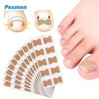 Pexmen 10/20/60Pcs Ingrown Toenail Correction Patch Toe Nail Correction Stickers Painless Pedicure Treatment Foot Care Tool