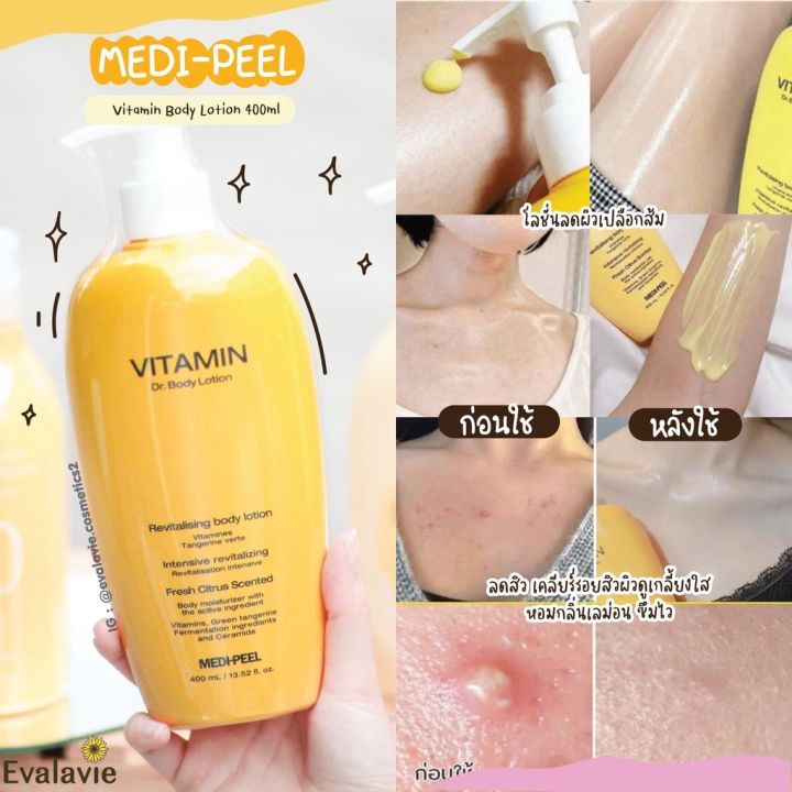 best-seller-ของแท้-รุ่นใหม่-medi-peel-vitamin-body-lotion-400ml-โลชั่นบำรุงผิวอ่อนแอด้วยวิตามินเข้มข้น-ดูแลผิวขั้นสุดยอด