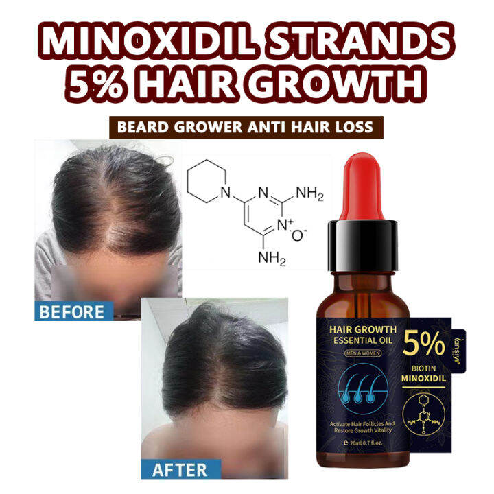 Minoxidil 5% Hair Grower Serum Biotin + minoxidil hair grower original ...