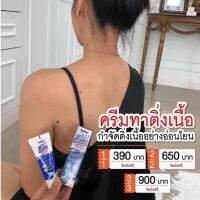 ส่งฟรี EELHOE ครีมทาตาปลา 20 g. ยาทาหูด ครีมทาหูด ตาปลา ครีมติ่งเนื้อ บำรุงผิว