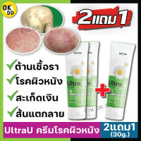 ส่งฟรี **[2แถม1] UltraU ครีมอัลตร้ายู ครีมแก้โรคผิวหนัง เชื้อราเรื้อรัง ผื่นคัน สะเก็ดเงิน กลากเกลื้อน เชื้อราที่เล็บ ขาหนีบ ร่มผ้า OK D D