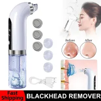 Electric Blackhead Remover Vacuum Suction Facial Pore Acne Cleaner Dead Skin Removal Face Cleaning Beauty Machine Skin Care Tool