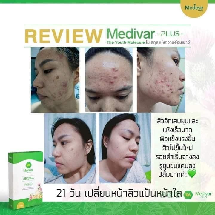 โปรวิตามินผิวสูตรคุณหมอใบเตย-medivar-plus-ดูแลจากภายในง่ายๆ-แค่วันละซอง-มี-wellnexcollagen-10-000-ml-เพียงพอต่อวัน