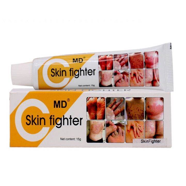 ORIGINAL Skin Cream for Allergies Fungis Itching Redness Rashes | Lazada PH