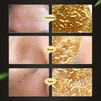 Gold Remove Blackhead Shrink Pore Improve Rough Skin Acne Shills Blackhead Remover Facial