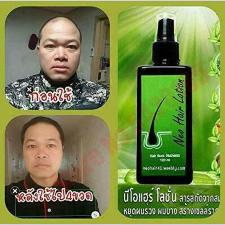 Neo Hair Lotion Hair Root HAIR BEARD SIDEBURNS LONGER Fast Growth Oil
