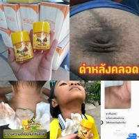 โทนเนอร์เช็ดคอดำ 50ml. (?3 ขวด/145.-) คอดำ รักแร้ดำ ขาหนีบดำข้อ ศอกดำ สิวที่หลัง ท้องดำหลังคลอด เช็ดล้างเครื่องสำอางออกได้ดีมาก