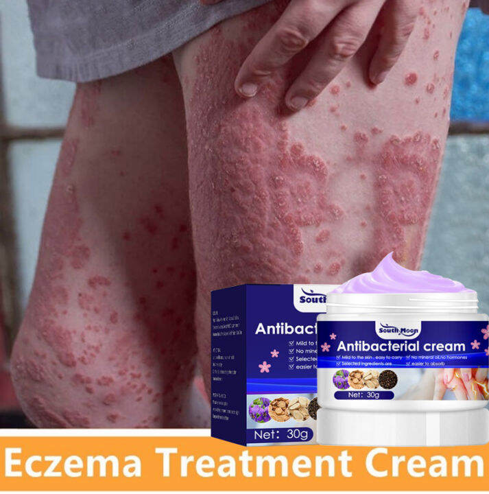 Atoderma Cream Original Gamot sa kati kati sa balat ointment eczema